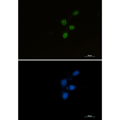 Chk2 Rabbit Monoclonal Antibody | 兔单抗 | EnkiLife恩玑生命