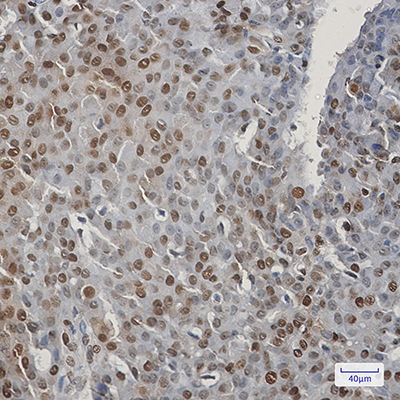 CIRBP Rabbit Monoclonal Antibody | 兔单抗 | EnkiLife恩玑生命