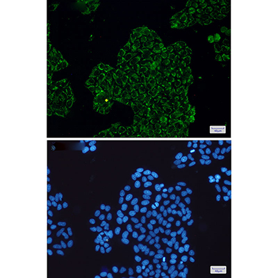 CLIC4 Rabbit Monoclonal Antibody | 兔单抗 | EnkiLife恩玑生命