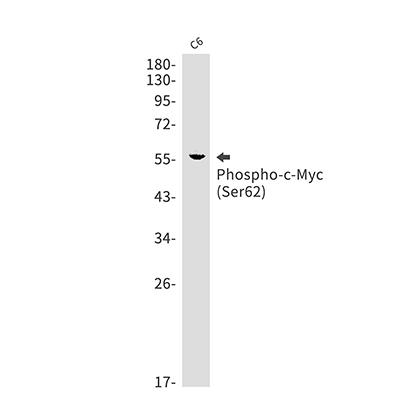 Phospho-c-Myc (Ser62) Rabbit Monoclonal Antibody | 兔单抗 | EnkiLife恩玑生命