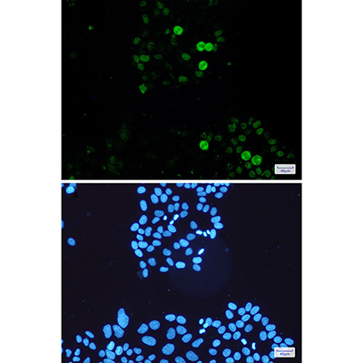 Phospho-c-Myc (Ser62) Rabbit Monoclonal Antibody | 兔单抗 | EnkiLife恩玑生命