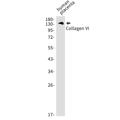 Collagen VI alpha 1 Rabbit Monoclonal Antibody | 兔单抗 | EnkiLife恩玑生命