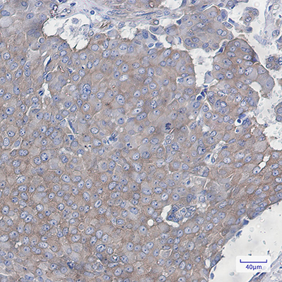 Cortactin Rabbit Monoclonal Antibody | 兔单抗 | EnkiLife恩玑生命