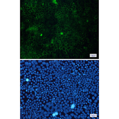 Cortactin Rabbit Monoclonal Antibody | 兔单抗 | EnkiLife恩玑生命