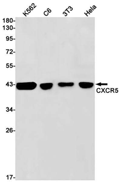 CXCR5 Rabbit Monoclonal Antibody | 兔单抗 | EnkiLife恩玑生命