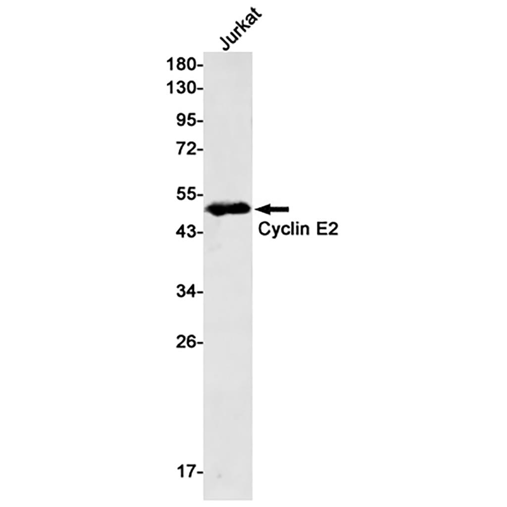 Cyclin E2 Rabbit Monoclonal Antibody | 兔单抗 | EnkiLife恩玑生命