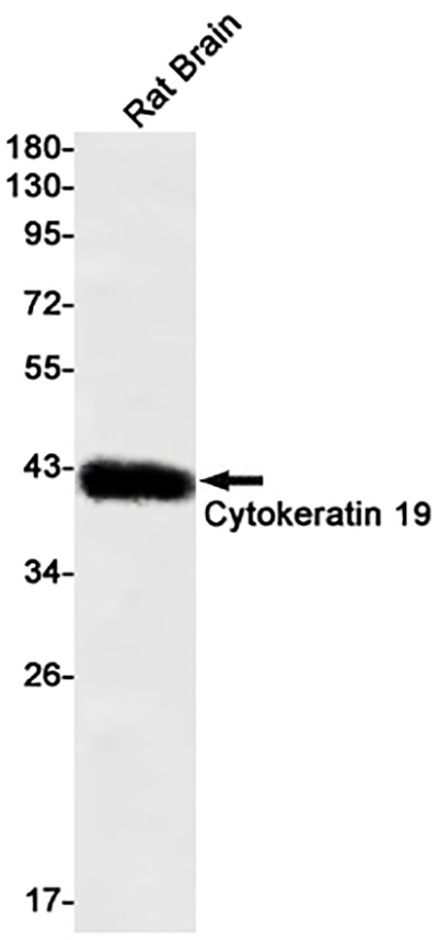 Cytokeratin 19 Rabbit Monoclonal Antibody | 兔单抗 | EnkiLife恩玑生命