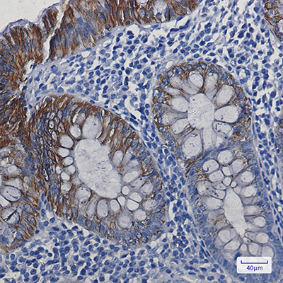 Cytokeratin 19 Rabbit Monoclonal Antibody | 兔单抗 | EnkiLife恩玑生命