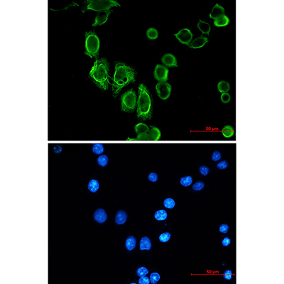 Cytokeratin 19 Rabbit Monoclonal Antibody | 兔单抗 | EnkiLife恩玑生命