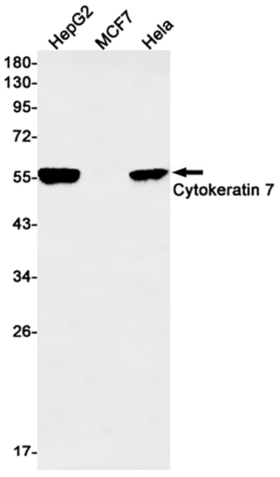 Cytokeratin 7 Rabbit Monoclonal Antibody | 兔单抗 | EnkiLife恩玑生命