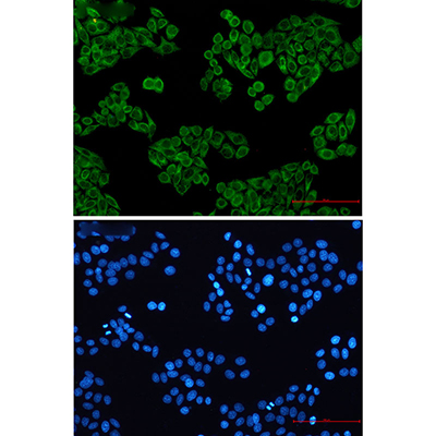 Cytokeratin 7 Rabbit Monoclonal Antibody | 兔单抗 | EnkiLife恩玑生命