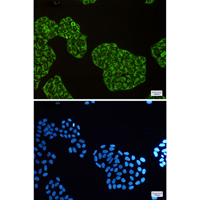DISC1 Rabbit Monoclonal Antibody | 兔单抗 | EnkiLife恩玑生命