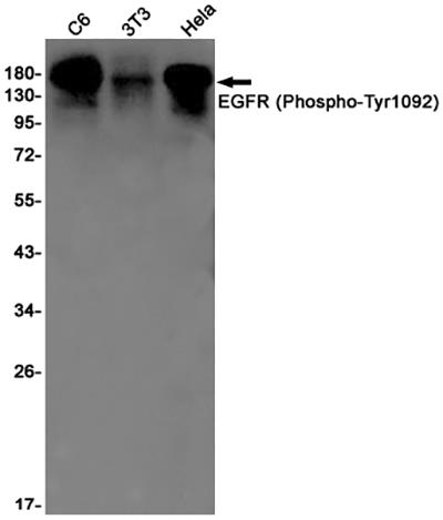 Phospho-EGFR (Tyr1092) Rabbit Monoclonal Antibody | 兔单抗 | EnkiLife恩玑生命