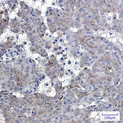 Phospho-EGFR (Tyr1092) Rabbit Monoclonal Antibody | 兔单抗 | EnkiLife恩玑生命