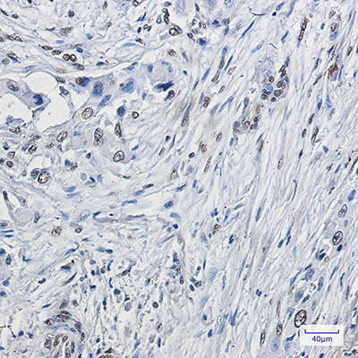 ELK1 Rabbit Monoclonal Antibody | 兔单抗 | EnkiLife恩玑生命