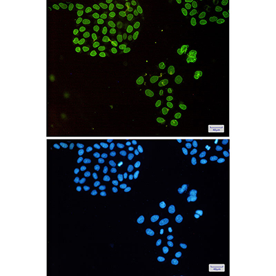 Emerin Rabbit Monoclonal Antibody | 兔单抗 | EnkiLife恩玑生命