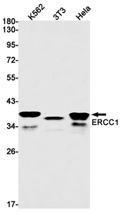 ERCC1 Rabbit Monoclonal Antibody | 兔单抗 | EnkiLife恩玑生命