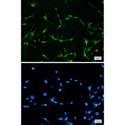 EWSR1 Rabbit Monoclonal Antibody | 兔单抗 | EnkiLife恩玑生命