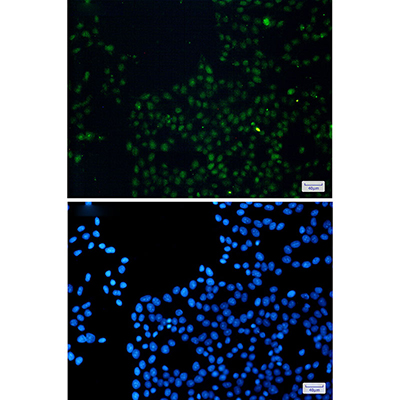 FAM98B Rabbit Monoclonal Antibody | 兔单抗 | EnkiLife恩玑生命