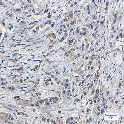 FBP1 Rabbit Monoclonal Antibody | 兔单抗 | EnkiLife恩玑生命