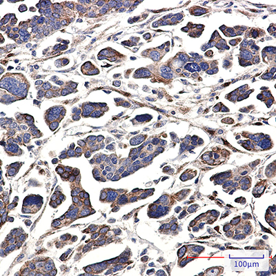 GNA13 Rabbit Monoclonal Antibody | 兔单抗 | EnkiLife恩玑生命