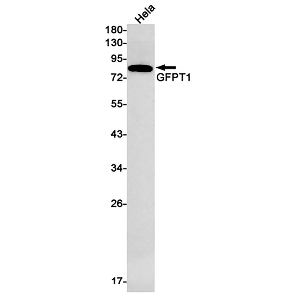GFPT1 Rabbit Monoclonal Antibody | 兔单抗 | EnkiLife恩玑生命