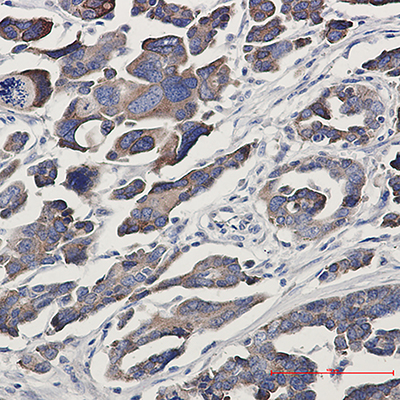 GFPT1 Rabbit Monoclonal Antibody | 兔单抗 | EnkiLife恩玑生命