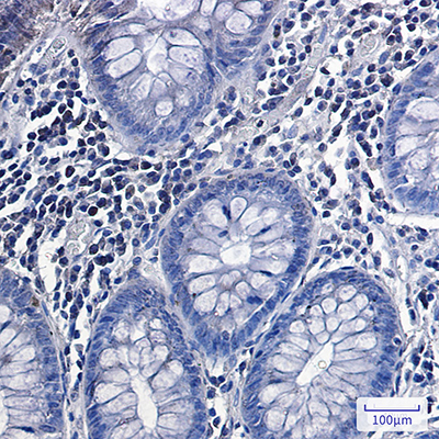 Phospho-Glycogen synthase (Ser641) Rabbit Monoclonal Antibody | 兔单抗 | EnkiLife恩玑生命
