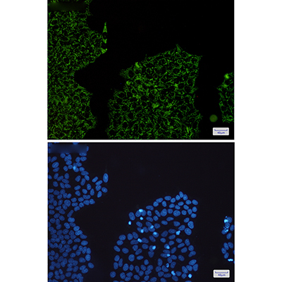 HADHA Rabbit Monoclonal Antibody | 兔单抗 | EnkiLife恩玑生命
