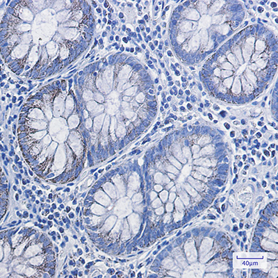 HADHA Rabbit Monoclonal Antibody | 兔单抗 | EnkiLife恩玑生命