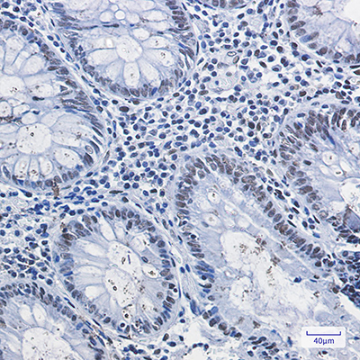 HDAC2 Rabbit Monoclonal Antibody | 兔单抗 | EnkiLife恩玑生命