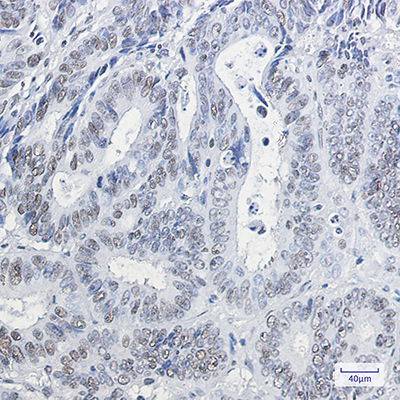 HP1 gamma Rabbit Monoclonal Antibody | 兔单抗 | EnkiLife恩玑生命