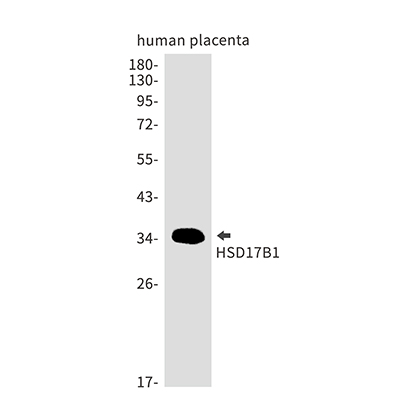 HSD17B1 Rabbit Monoclonal Antibody | 兔单抗 | EnkiLife恩玑生命