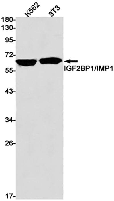 IGF2BP1 Rabbit Monoclonal Antibody | 兔单抗 | EnkiLife恩玑生命