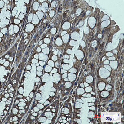 IGF2BP1 Rabbit Monoclonal Antibody | 兔单抗 | EnkiLife恩玑生命