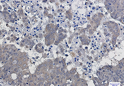 IKB beta Rabbit Monoclonal Antibody | 兔单抗 | EnkiLife恩玑生命