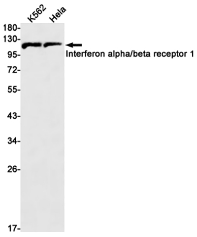 Interferon alpha/beta Receptor 1 Rabbit Monoclonal Antibody | 兔单抗 | EnkiLife恩玑生命
