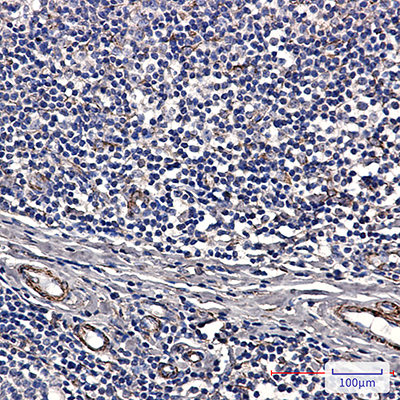 IRAK4 Rabbit Monoclonal Antibody | 兔单抗 | EnkiLife恩玑生命