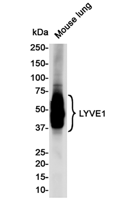 LYVE1 Rabbit Monoclonal Antibody | 兔单抗 | EnkiLife恩玑生命