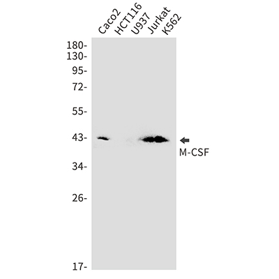 M-CSF Rabbit Monoclonal Antibody | 兔单抗 | EnkiLife恩玑生命