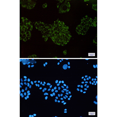 MEKK2 Rabbit Monoclonal Antibody | 兔单抗 | EnkiLife恩玑生命