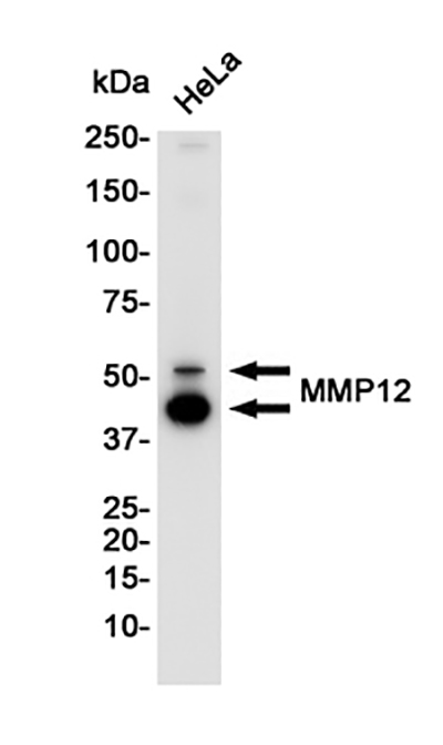 MMP12 Rabbit Monoclonal Antibody | 兔单抗 | EnkiLife恩玑生命