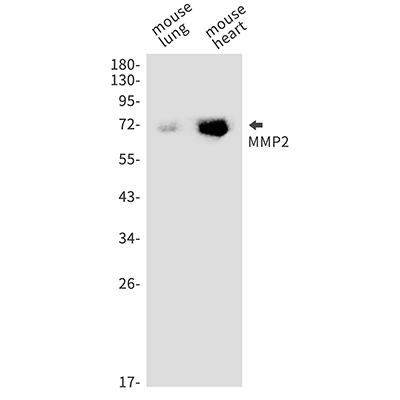 MMP2 Rabbit Monoclonal Antibody | 兔单抗 | EnkiLife恩玑生命