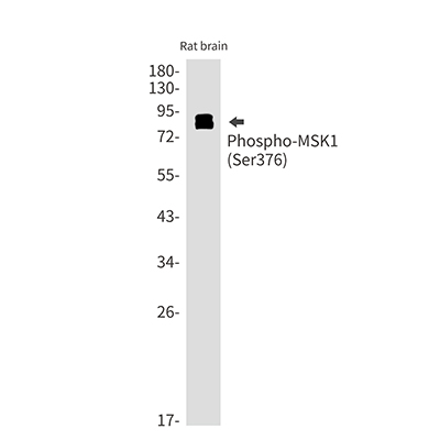 Phospho-MSK1 (Ser376) Rabbit Monoclonal Antibody | 兔单抗 | EnkiLife恩玑生命