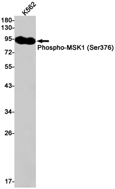 Phospho-MSK1 (Ser376) Rabbit Monoclonal Antibody | 兔单抗 | EnkiLife恩玑生命