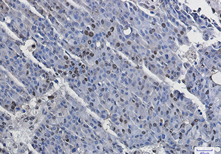 Phospho-MSK1 (Ser376) Rabbit Monoclonal Antibody | 兔单抗 | EnkiLife恩玑生命