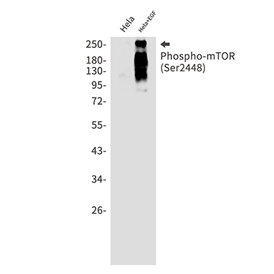 Phospho-mTOR (Ser2448) Rabbit Monoclonal Antibody | 兔单抗 | EnkiLife恩玑生命