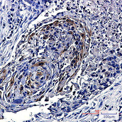 Phospho-mTOR (Ser2448) Rabbit Monoclonal Antibody | 兔单抗 | EnkiLife恩玑生命