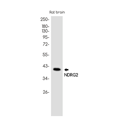 NDRG2 Rabbit Monoclonal Antibody | 兔单抗 | EnkiLife恩玑生命