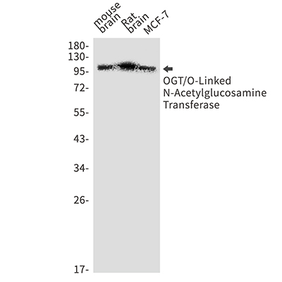 OGT Rabbit Monoclonal Antibody | 兔单抗 | EnkiLife恩玑生命